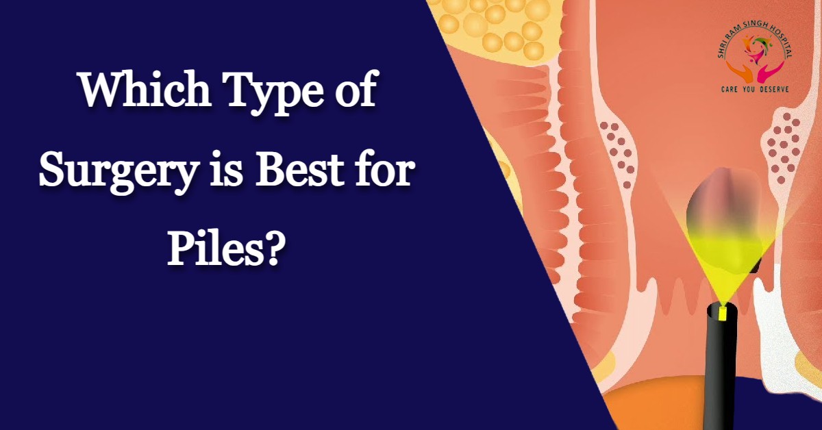 Which Type of Surgery is Best for Piles?