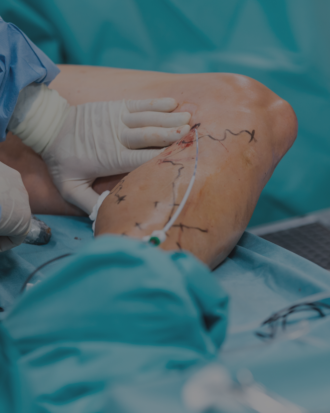Vascular Surgery